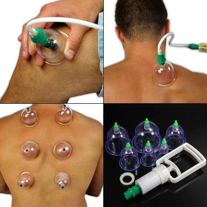 KL Θεραπευτική Συσκευή με Βεντούζες 24τμχ - Pull Out A Vacuum Apparatus 24pcs