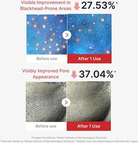 Medicube Hypochlorous Acid Peel Mask