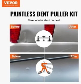 VEVOR Car Body Dent Puller Bridge Lifter Tool Paintless Hail Remover Repair Kit